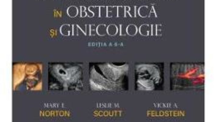 Cartea Callen. Ultrasonografie in Obstretica si Ginecologie – Mary E. Norton, Leslie M. Scoutt, Vickie A. Feldstein (download, pret, reducere)