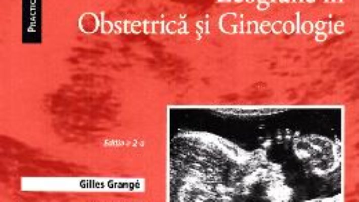 Cartea Ghid practic de ecografie in obstetrica si ginecologie – Gilles Grange (download, pret, reducere)