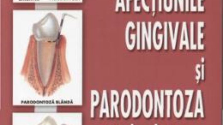 Afectiunile gingivale si paradontoza pe intelesul tuturor – Nouri Davijani Mahnoush PDF (download, pret, reducere)